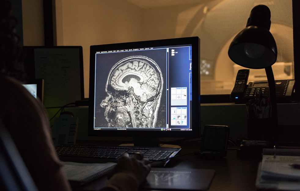 desktop computer screen showing an MRI image of a human brain